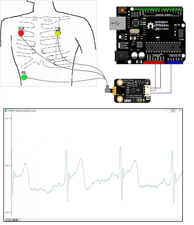 Gravity: Arduino Heart Rate Monitor Sensor (ECG) -DFRobot