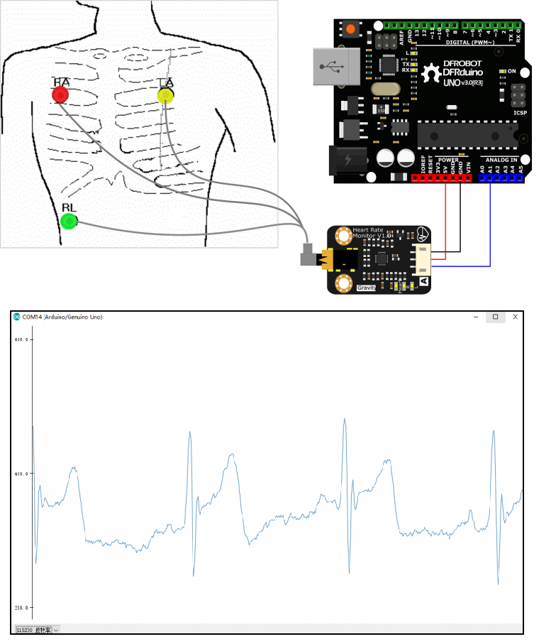 Gravity: Arduino Heart Rate Monitor Sensor (ECG) -KDRobotKit